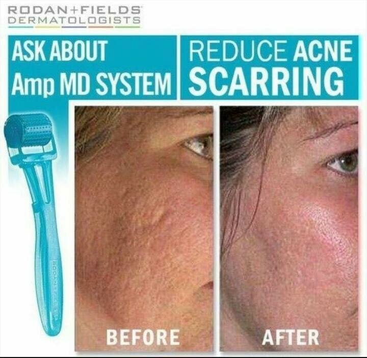 Rodan + Fields 