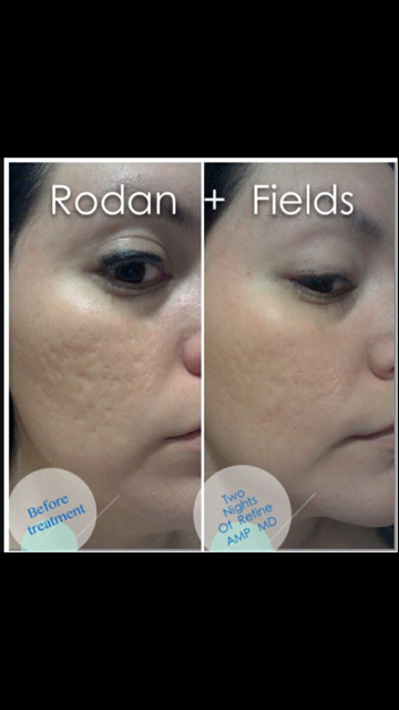 Rodan + Fields 