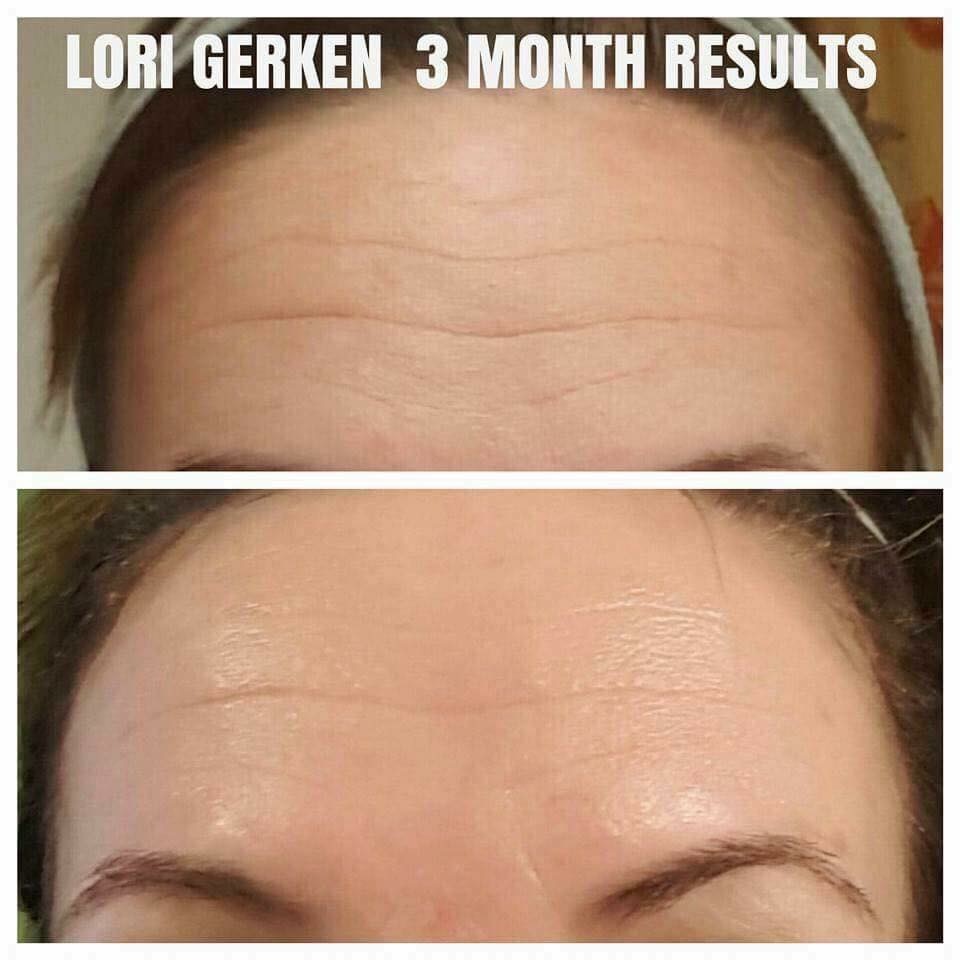 Rodan + Fields