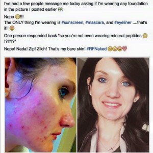 Unblemish Rodan + Fields 