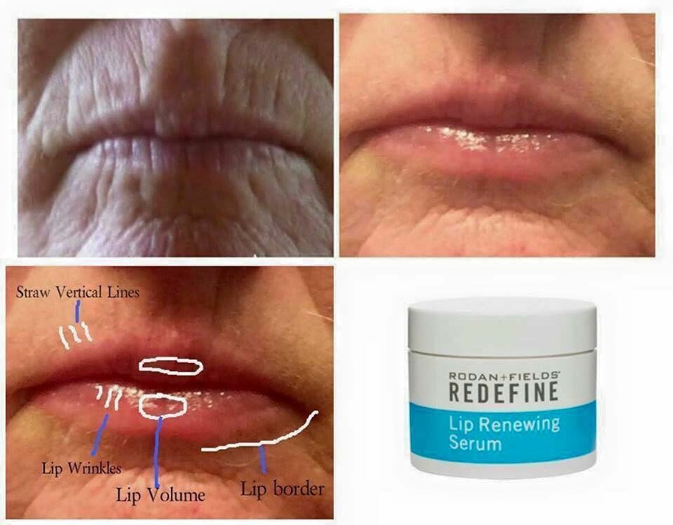 Rodan + Fields 