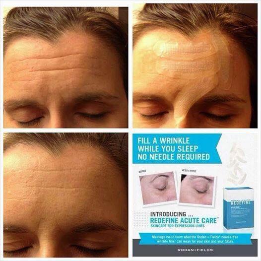 REDEFINE Acute Care